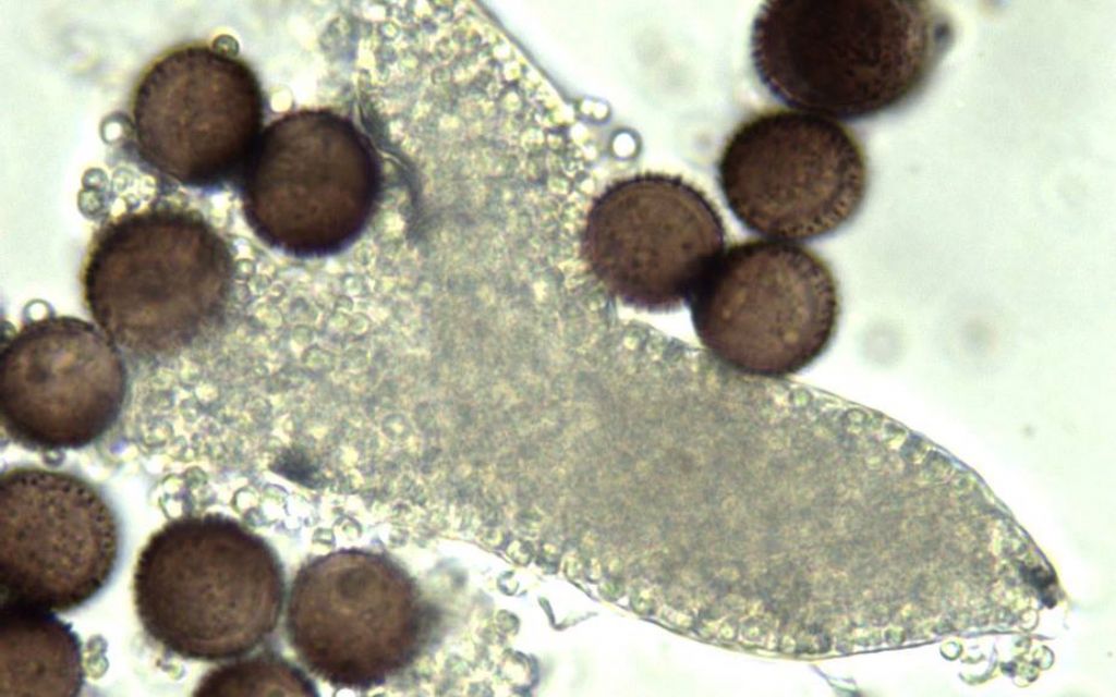 Physarum decipiniens (??)